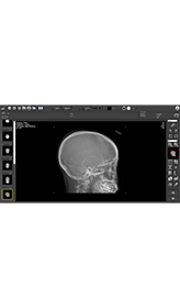 Magellan和Sirius医用X光影像处理软件